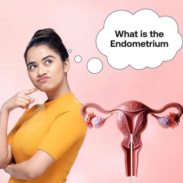 IUI –Intrauterine Insemination or Artificial Insemination (AI)